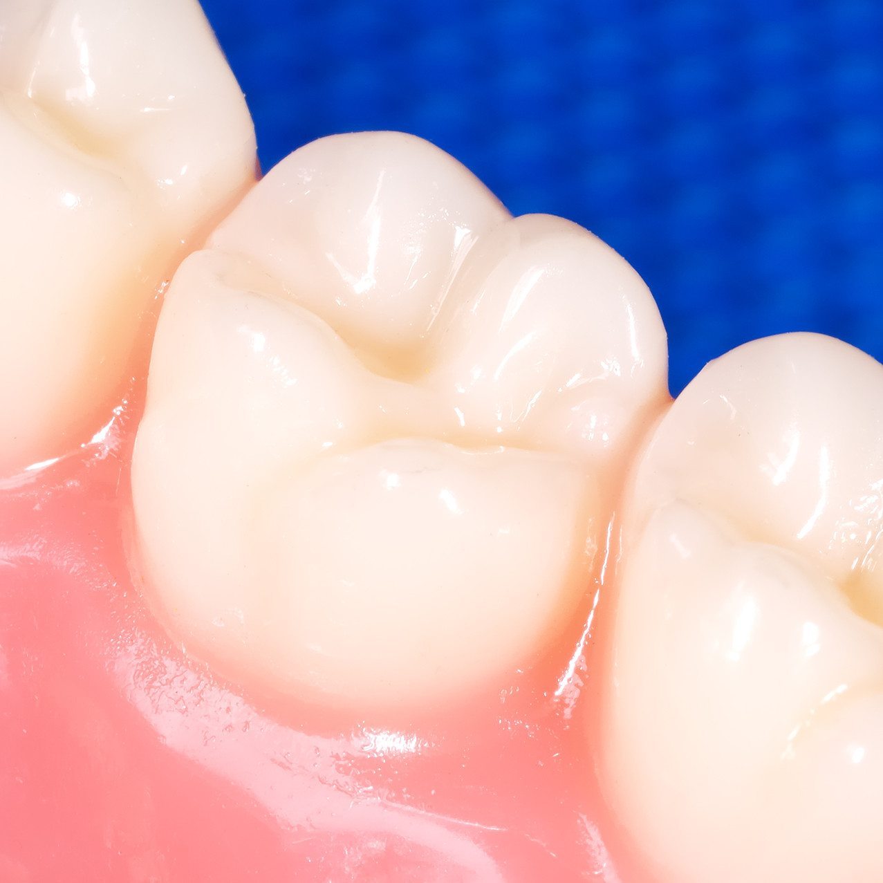 periodontics service image Dentistry of the Carolinas